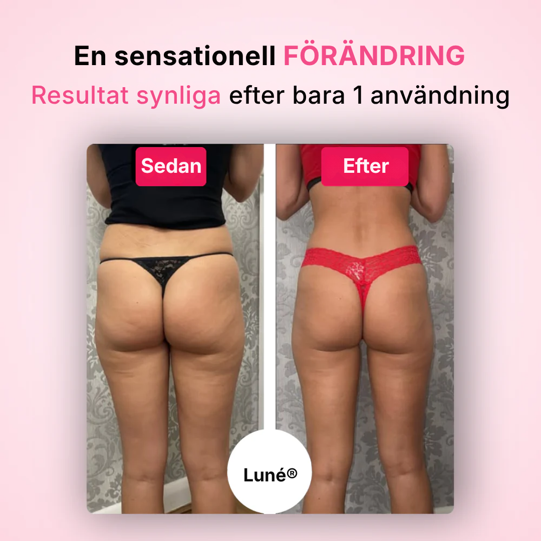 Luné® | set för att ta bort celluliter
