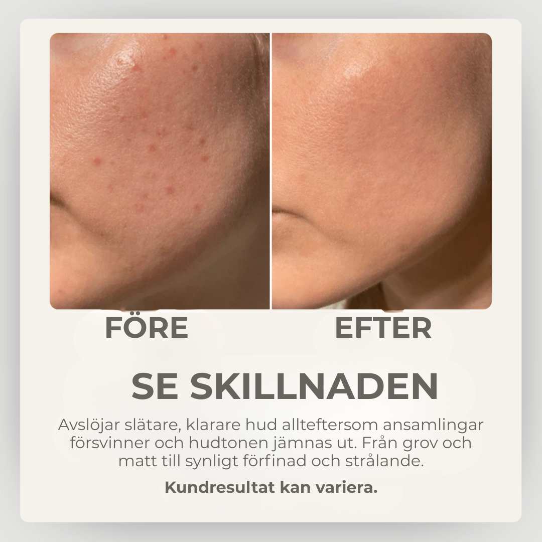 StrålandeHud® | Säg Hej Då till Orenheter – Hej till Strålande Hud!