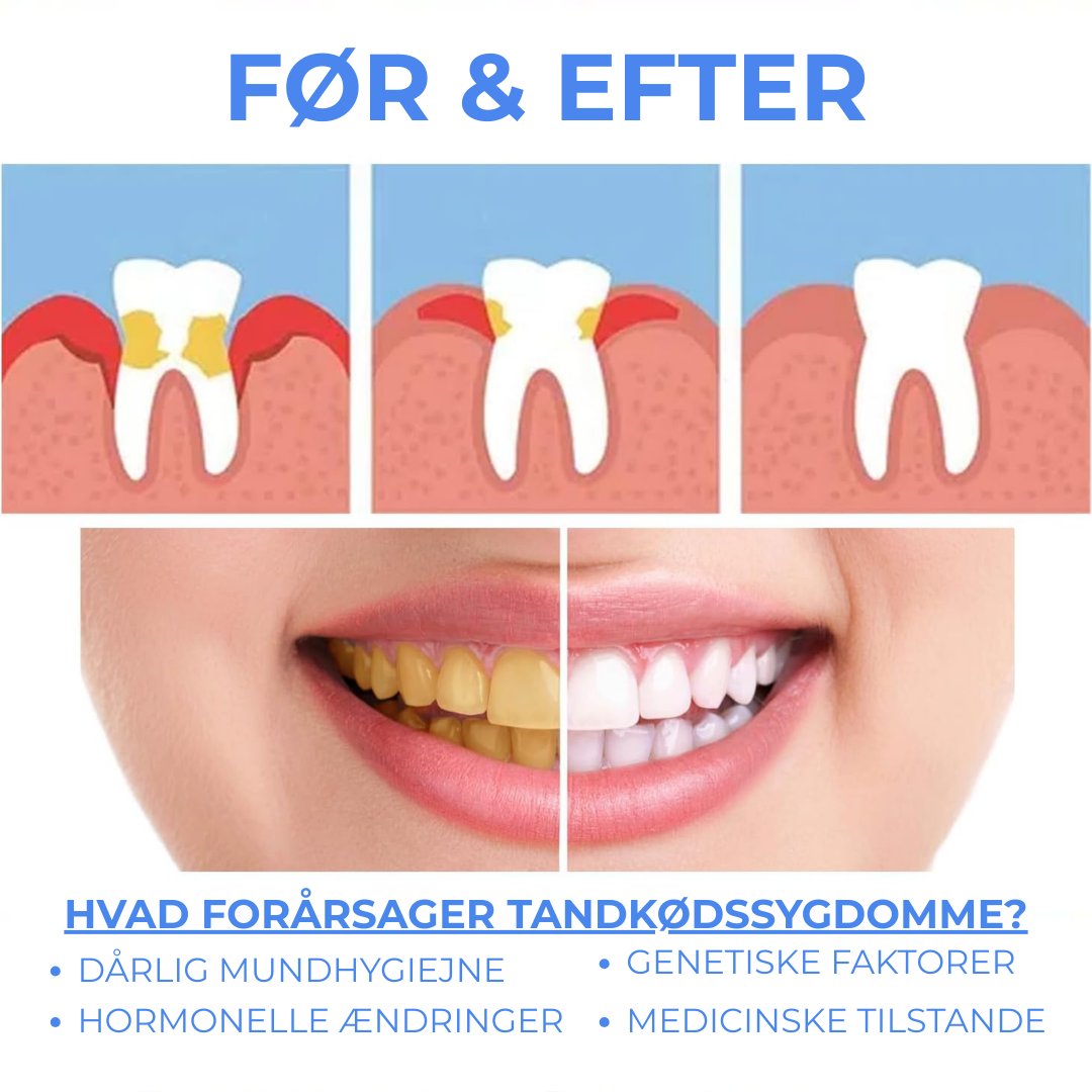 PuraGen® | Friskare tandkött och upp till 95 % vitare tänder på bara 3 dagar!
