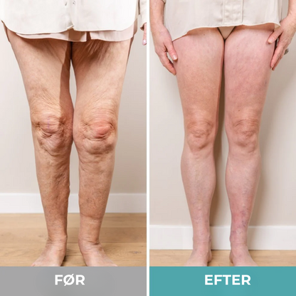 TrinZen® | Det smarta sättet att lugna dina fötter – utan piller eller tidsbokningar