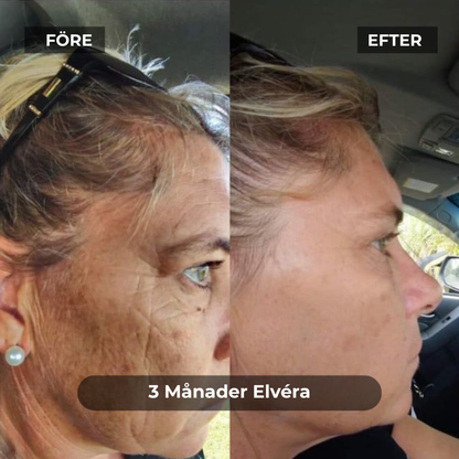 Elvéra® | Glöd Som Aldrig Förr – Den Banbrytande Anti-Aging Genombrottet för Hemmet är Här!