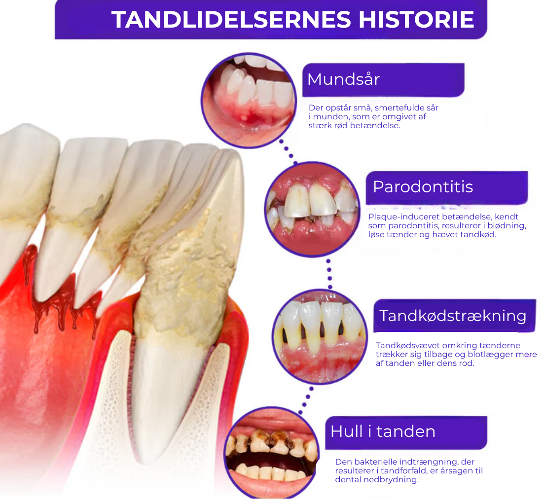 BioSmil® | Bi-gift Tandterapi Oral Power