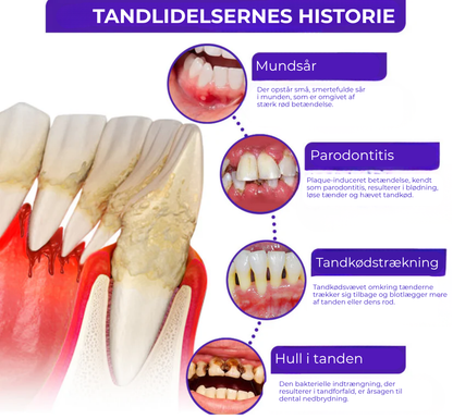 BioSmil® | Bi-gift Tandterapi Oral Power