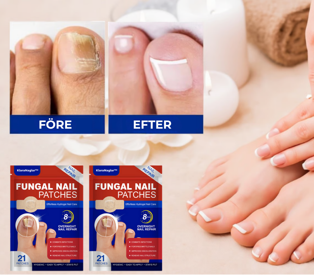 KlaraNaglar™ | Slip af med neglesvamp for altid – se resultater på kun 2 uger!