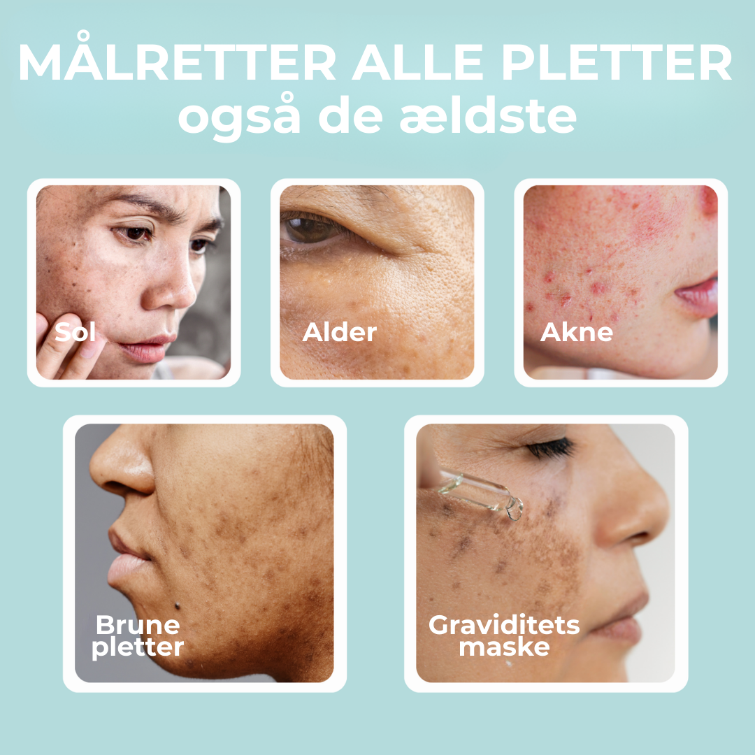 RenGlöd® | Anti-Mörkfläck Creme