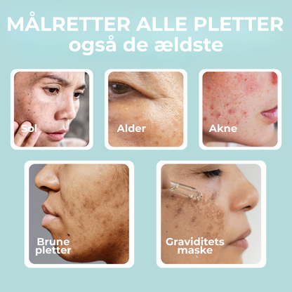 RenGlöd® | Anti-Mörkfläck Creme