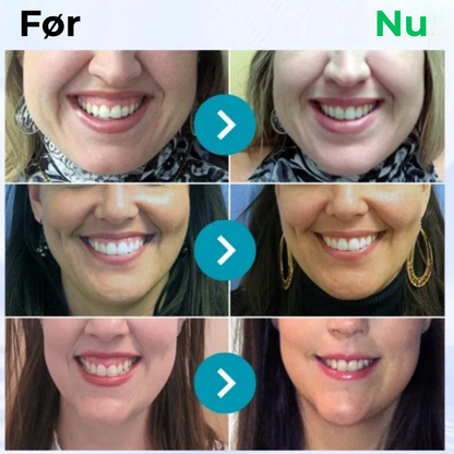 BioSmil® | Bi-gift Tandterapi Oral Power