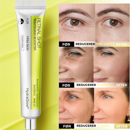 HydraGlow® | Botox & Vita-A Retinol Shot Rynkeförbättrande Fastgöringskräm - Återfå ungdomlig hud nu