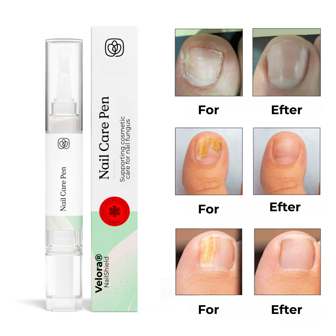 Velora® Nagelskydd | Den naturliga lösningen för starka, friska och svampfria naglar!