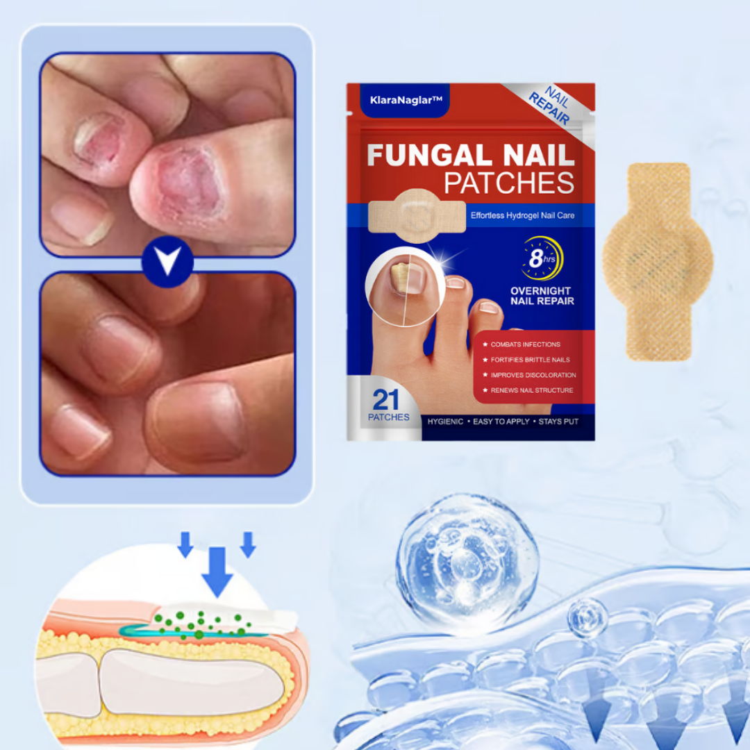 KlaraNaglar™ | Slip af med neglesvamp for altid – se resultater på kun 2 uger!