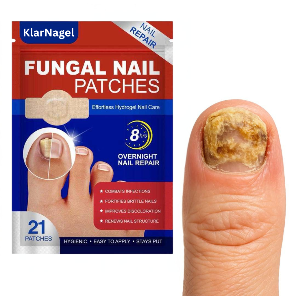 KlarNagel® | Lappar för nagelreparation