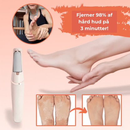 SilkSteps® | Omedelbar borttagning av hård hud för babymjuka fötter