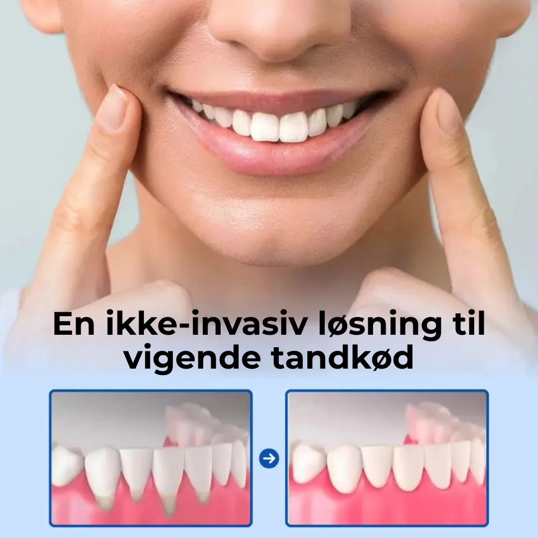 TandRo® | Stoppa tandköttsretraktion naturligt, smärtfritt och på bara 3 dagar!