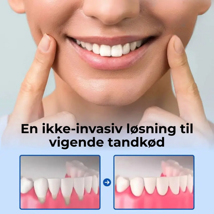 TandRo® | Stoppa tandköttsretraktion naturligt, smärtfritt och på bara 3 dagar!