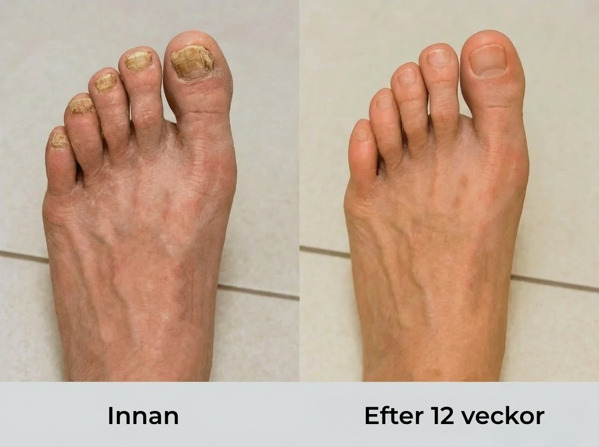 Nailura® | Nagelvårdspenna