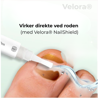 Velora® Nagelskydd | Den naturliga lösningen för starka, friska och svampfria naglar!