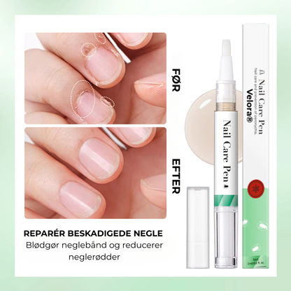 Velora® Nagelskydd | Den naturliga lösningen för starka, friska och svampfria naglar!