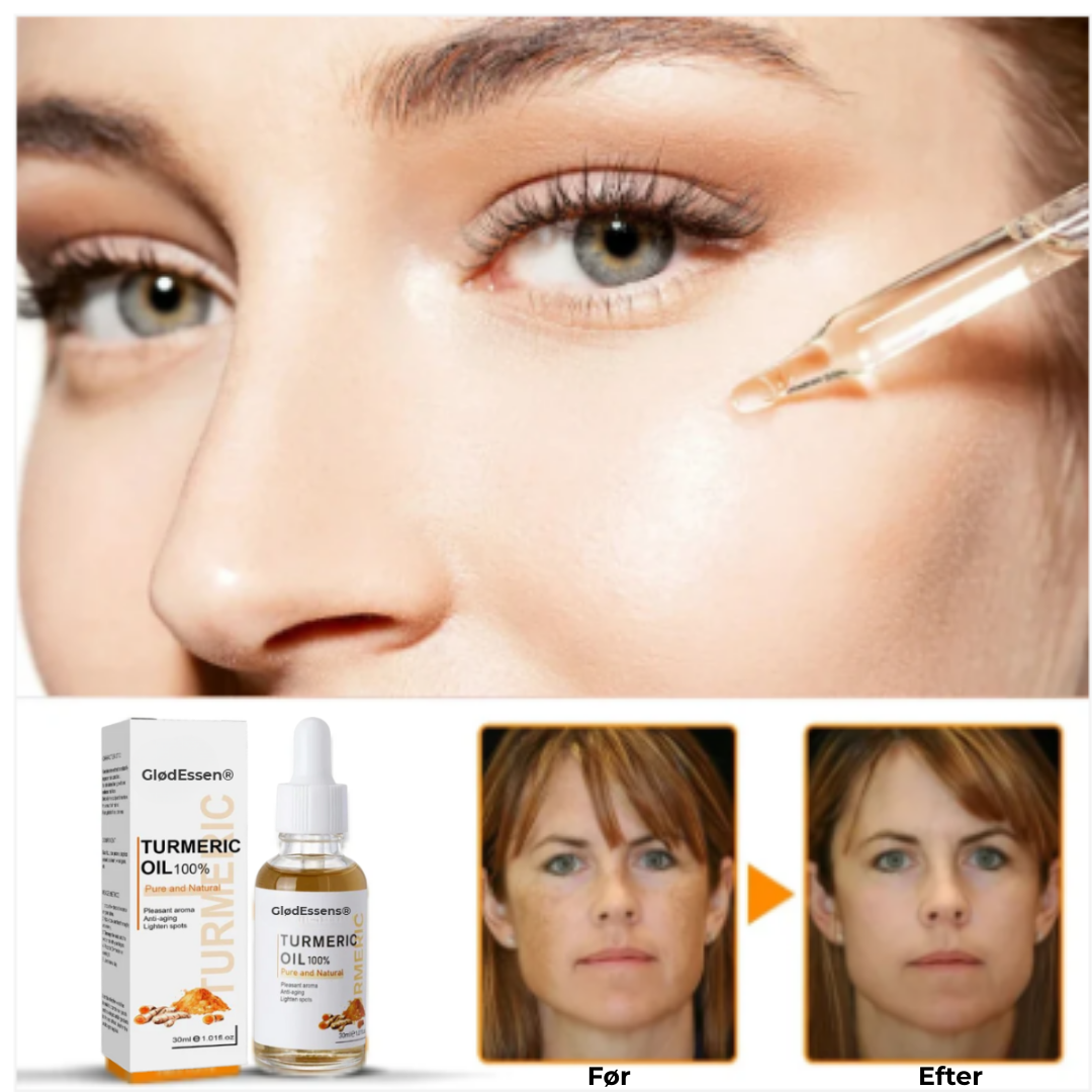 GlødEssens® Serum mot Mörka Fläckar