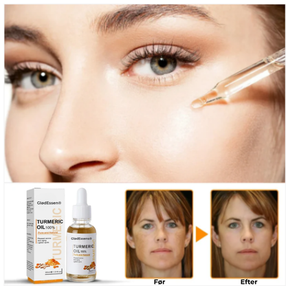 GlødEssens® Serum mot Mörka Fläckar