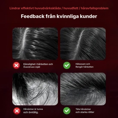 Scyn® | Smart hårbottenmassager