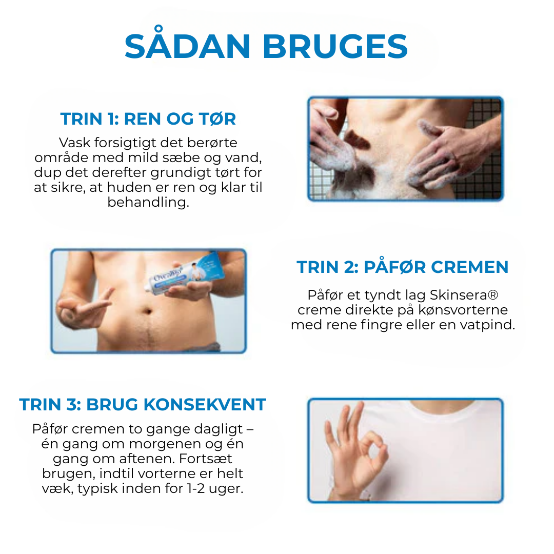 Skinsera® HPV Vårtor Lättnad Kräm