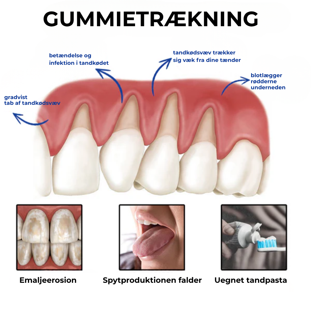 BioSmil® | Bi-gift Tandterapi Oral Power
