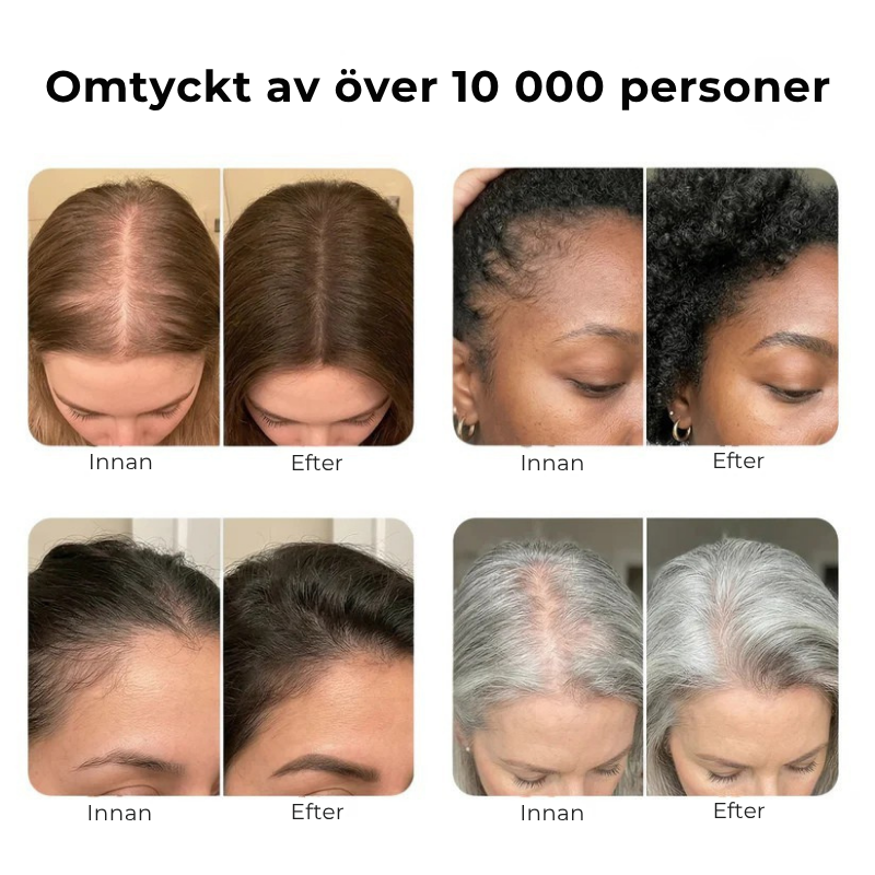 Hairlux® | Koreas mest populära hårväxtserum