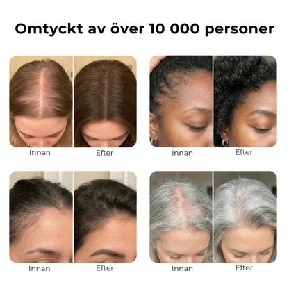 Hairlux® | Koreas mest populära hårväxtserum