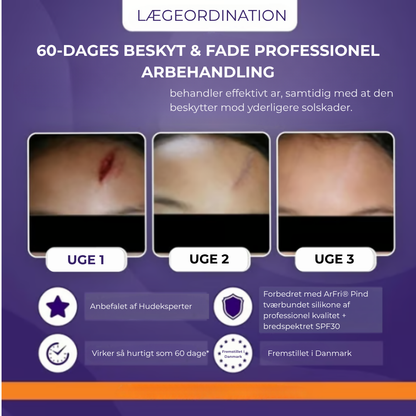 ArFri® Stick | Hud Ar-Lösning🛡️ 60 % Silikon Stick mot Ärr