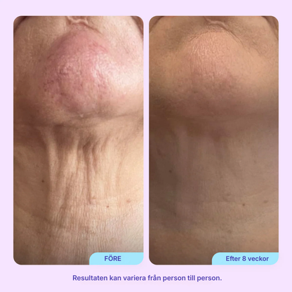 Firmora® | Sculpt & Lift halskräm