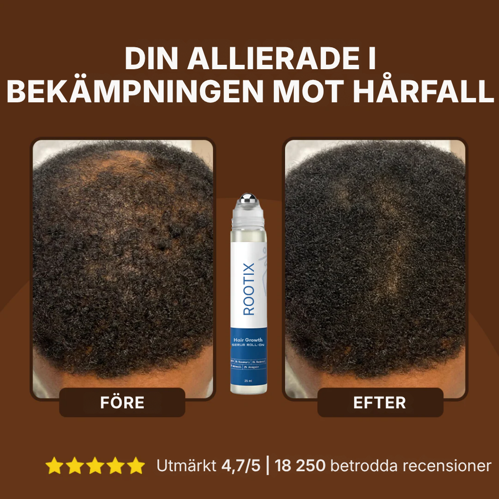 Rootix® | Rosmarin-roll-on-serum för hårväxt