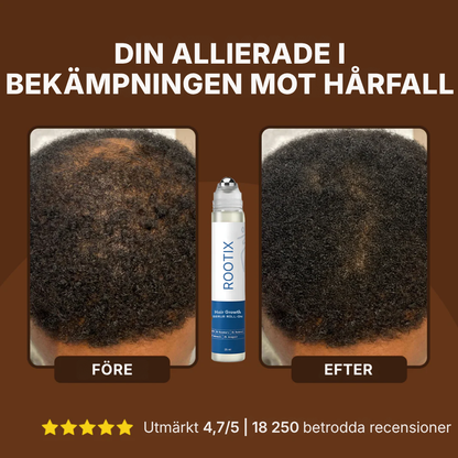 Rootix® | Rosmarin-roll-on-serum för hårväxt