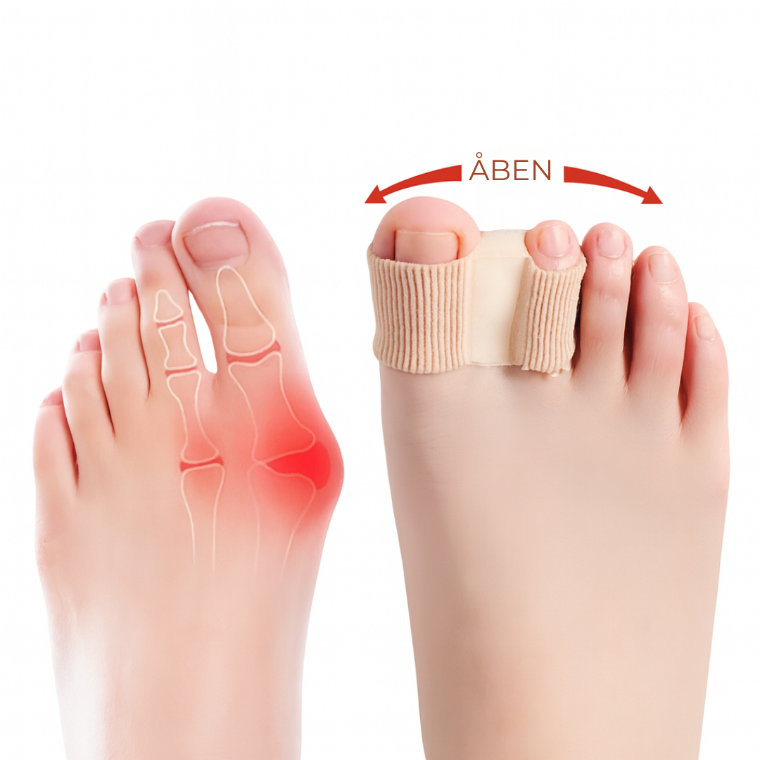 FlexiToe® | Skonsam tåjustering för daglig lindring
