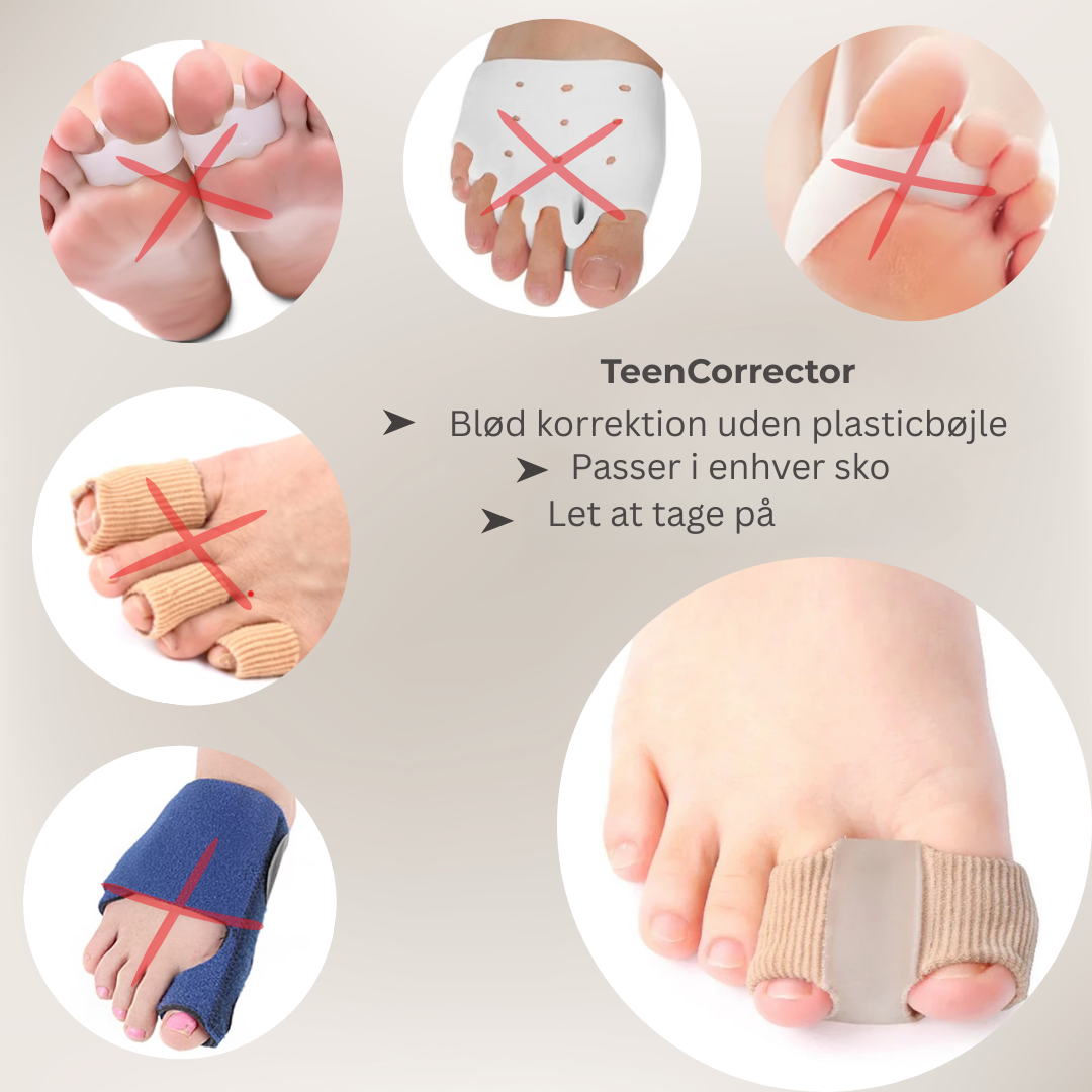 FlexiToe® | Skonsam tåjustering för daglig lindring