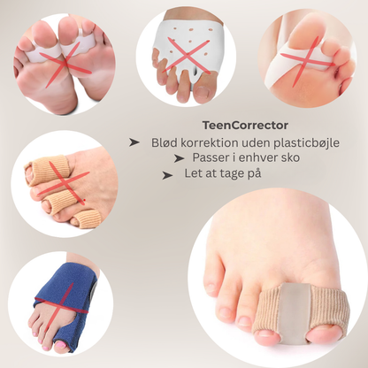 FlexiToe® | Skonsam tåjustering för daglig lindring