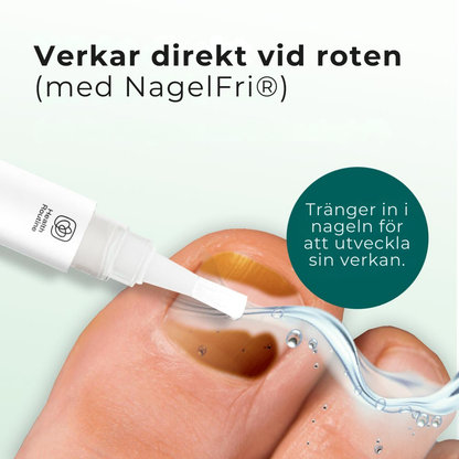 NagelFri® | Sluta gömma dina naglar – bli av med nagelsvamp från roten på bara 12 veckor!