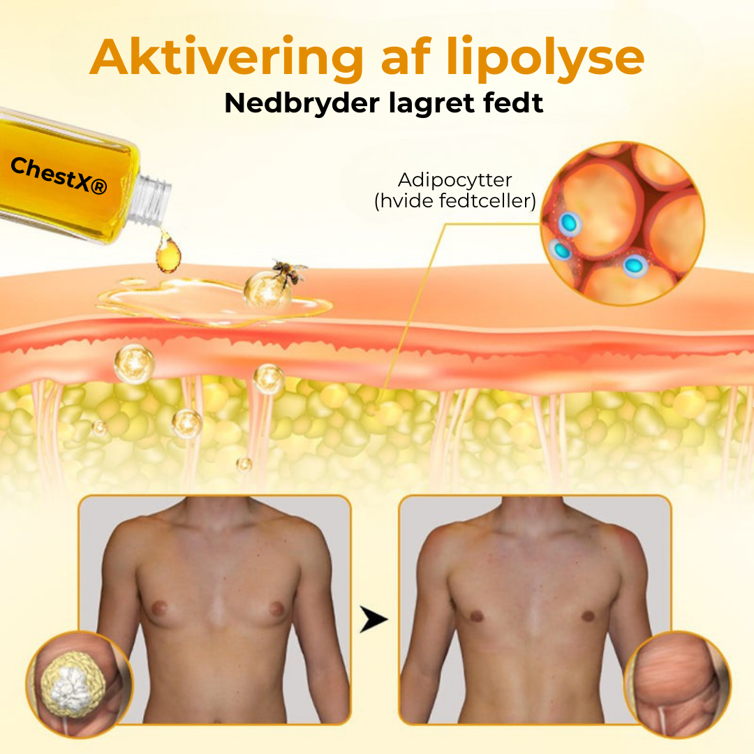 ChestX® Bröst Redefinerare | Bi-olja för behandling av gynekomasti