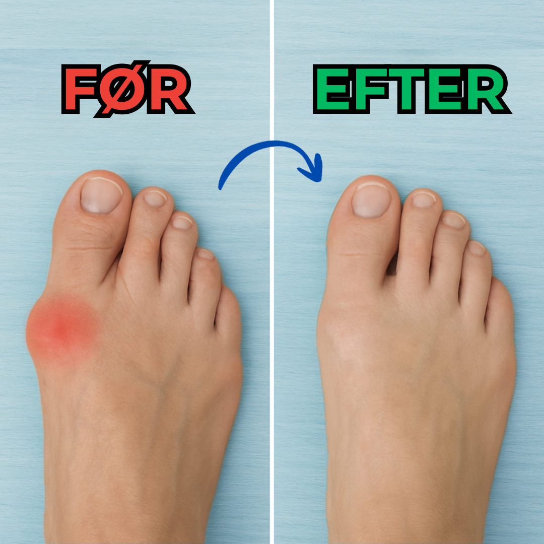 Orthovell® | Lindra dina fötter idag, utan avtal eller medicin