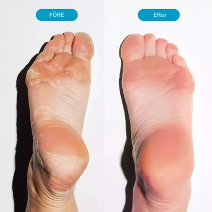 PediPure® | Nagelvårdsspray för friska fötter och naglar