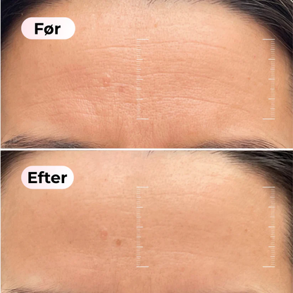 SkønAura® | Bio-Kollagen Mask + Borste.