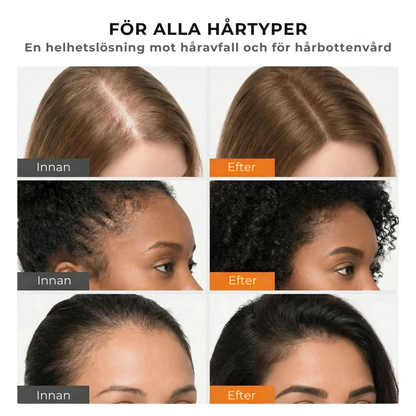 Hairlux® | Koreas mest populära hårväxtserum