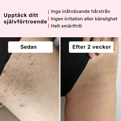 Silka® | hårborttagningsset