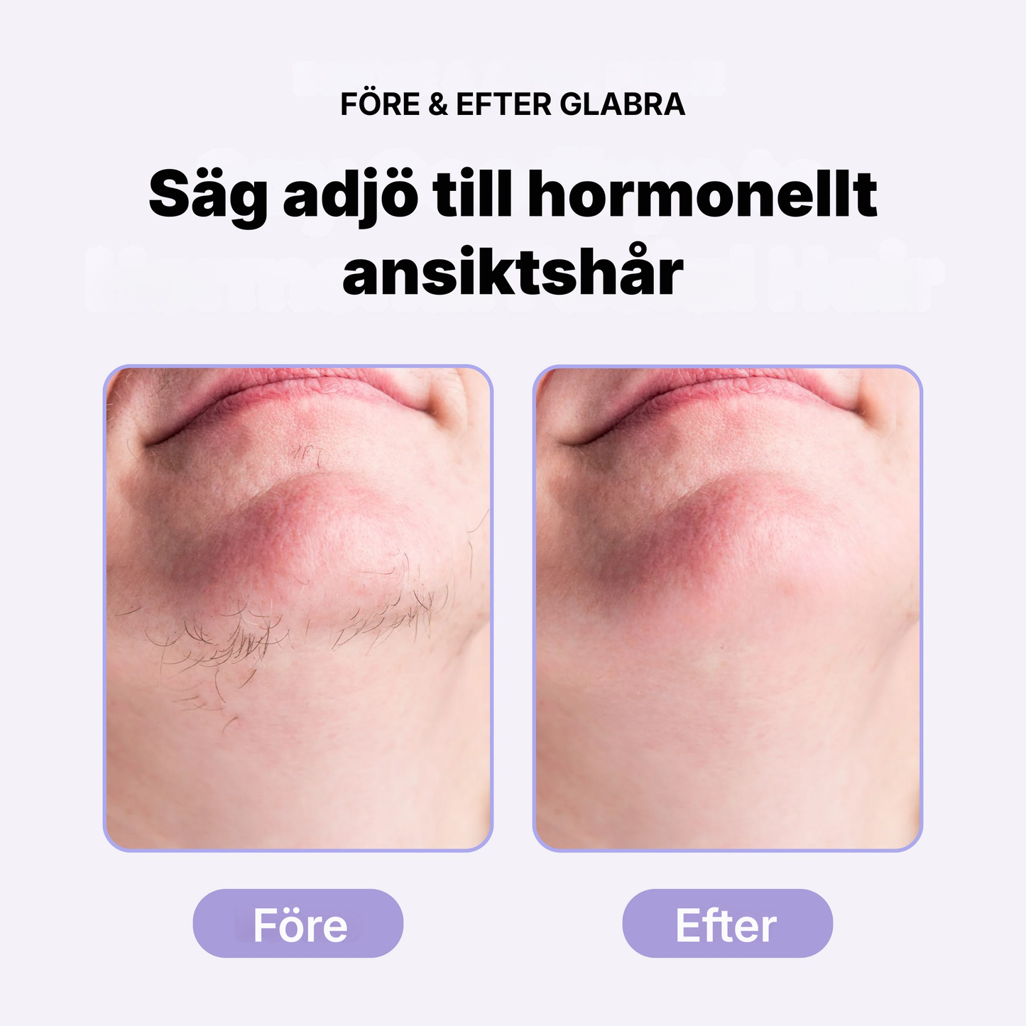 Glabra® | Effektiv hårborttagning i ansiktet utan inåtväxande hårstrån