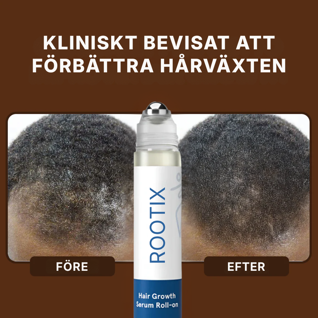 Rootix® | Rosmarin-roll-on-serum för hårväxt