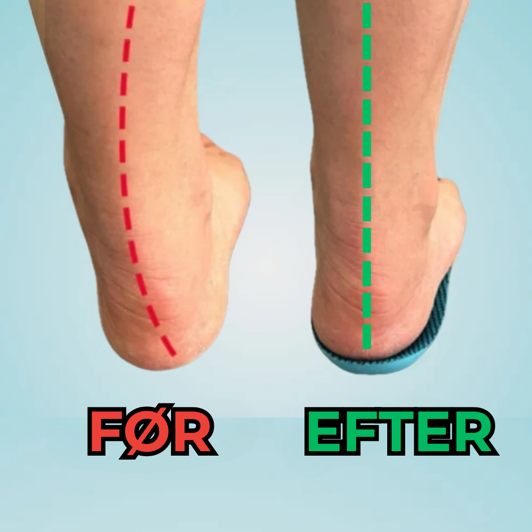 Orthovell® | Lindra dina fötter idag, utan avtal eller medicin