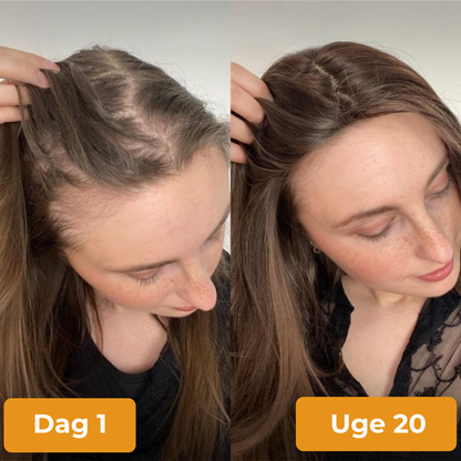 HairVita® | Pumpakärnolja - mjukgeléer