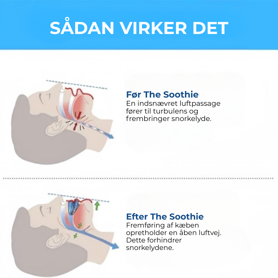 SnorkFri® | Anti-snarkmunstycke Universell Storlek