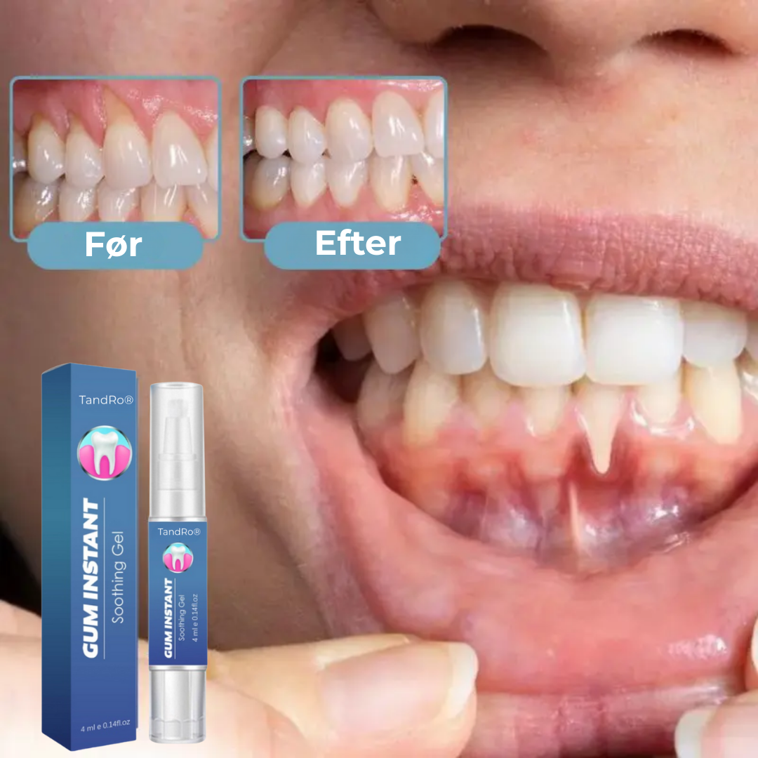 TandRo® | Stoppa tandköttsretraktion naturligt, smärtfritt och på bara 3 dagar!