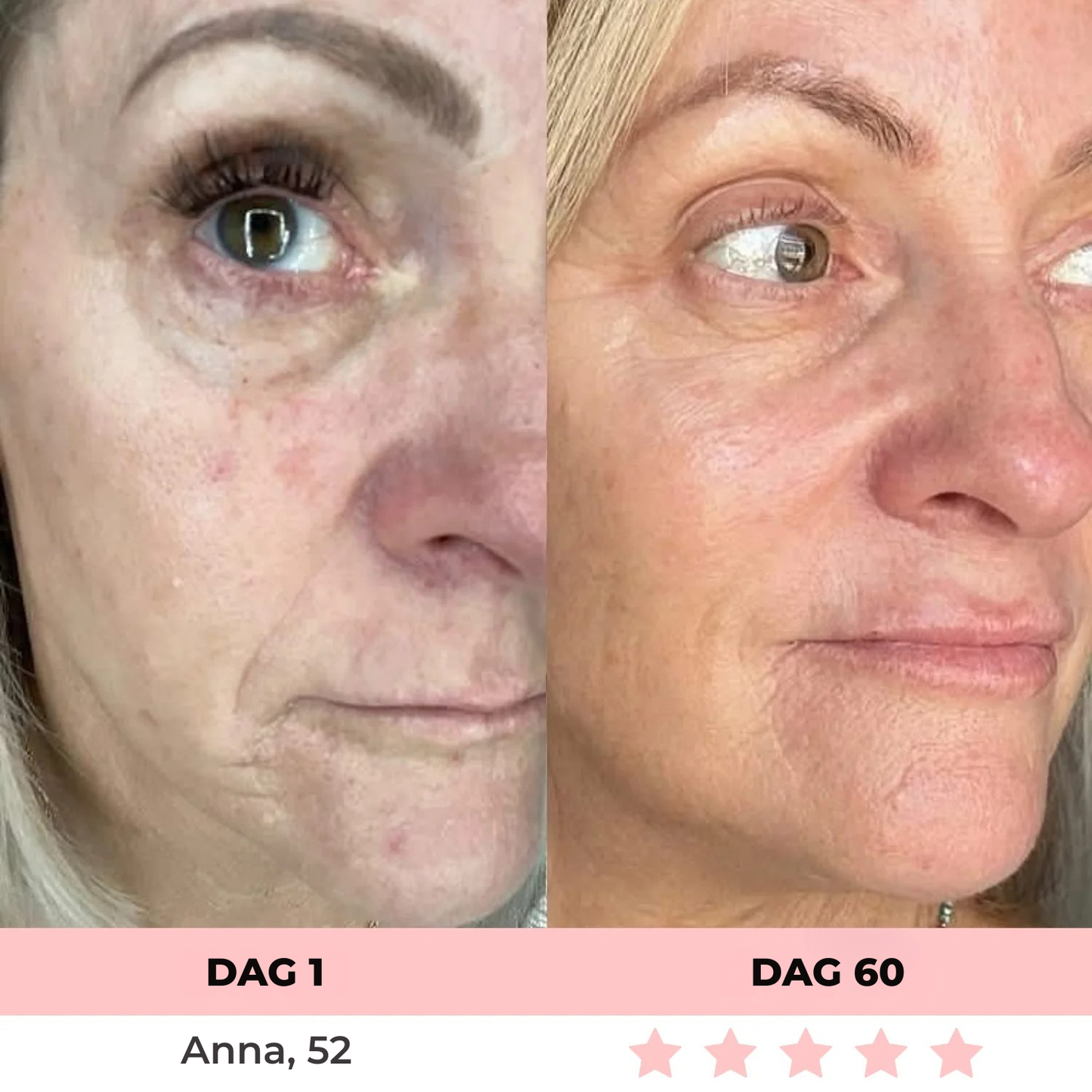 Skinlux® | 7-i-1 LED-ansiktsvårdsapparat