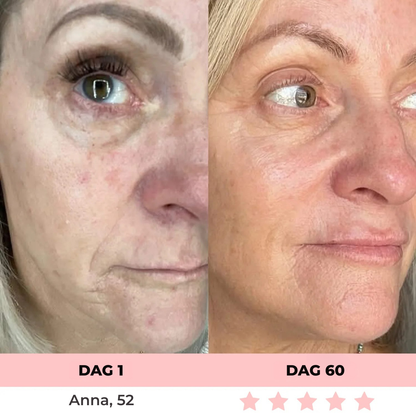 Skinlux® | 7-i-1 LED-ansiktsvårdsapparat